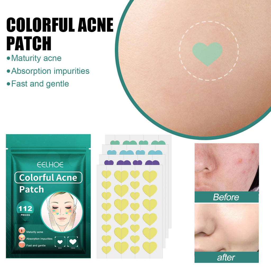 Colorful Heart Acne Patches - 112 Count (US Warehouse)